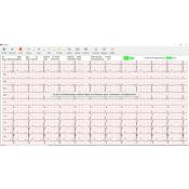 Cardiomate PC-ECG Bluetooth Spengler