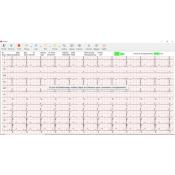 Cardiomate PC-ECG Spengler