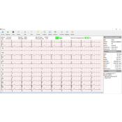 Cardiomate PC-ECG Spengler